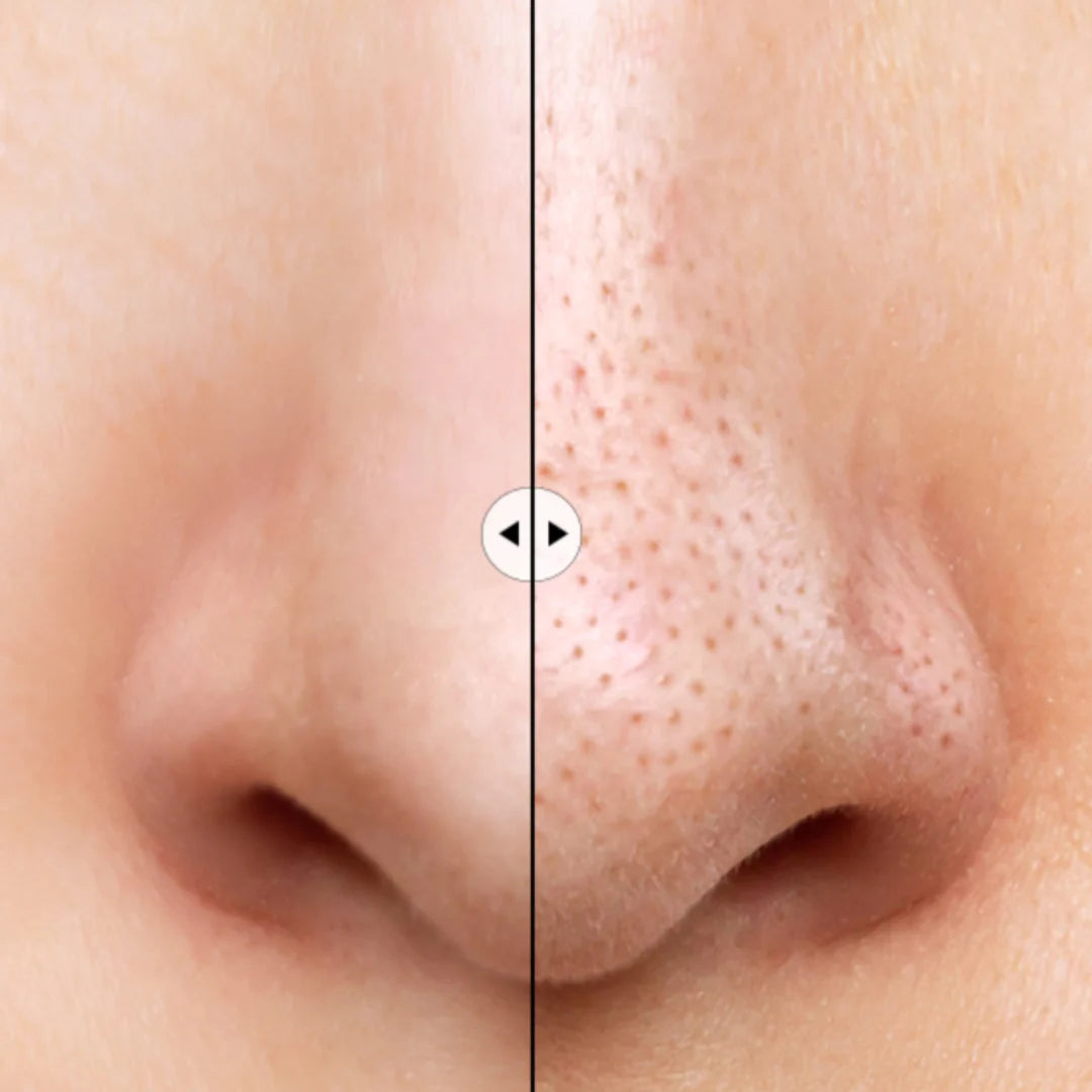 ILSO - NATURAL MILD CLEAR NOSE PACK 3g/4g