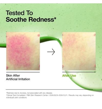 ANUA - AZELAIC ACID 10 HYALURON REDNESS SOOTHING SERUM 30ML